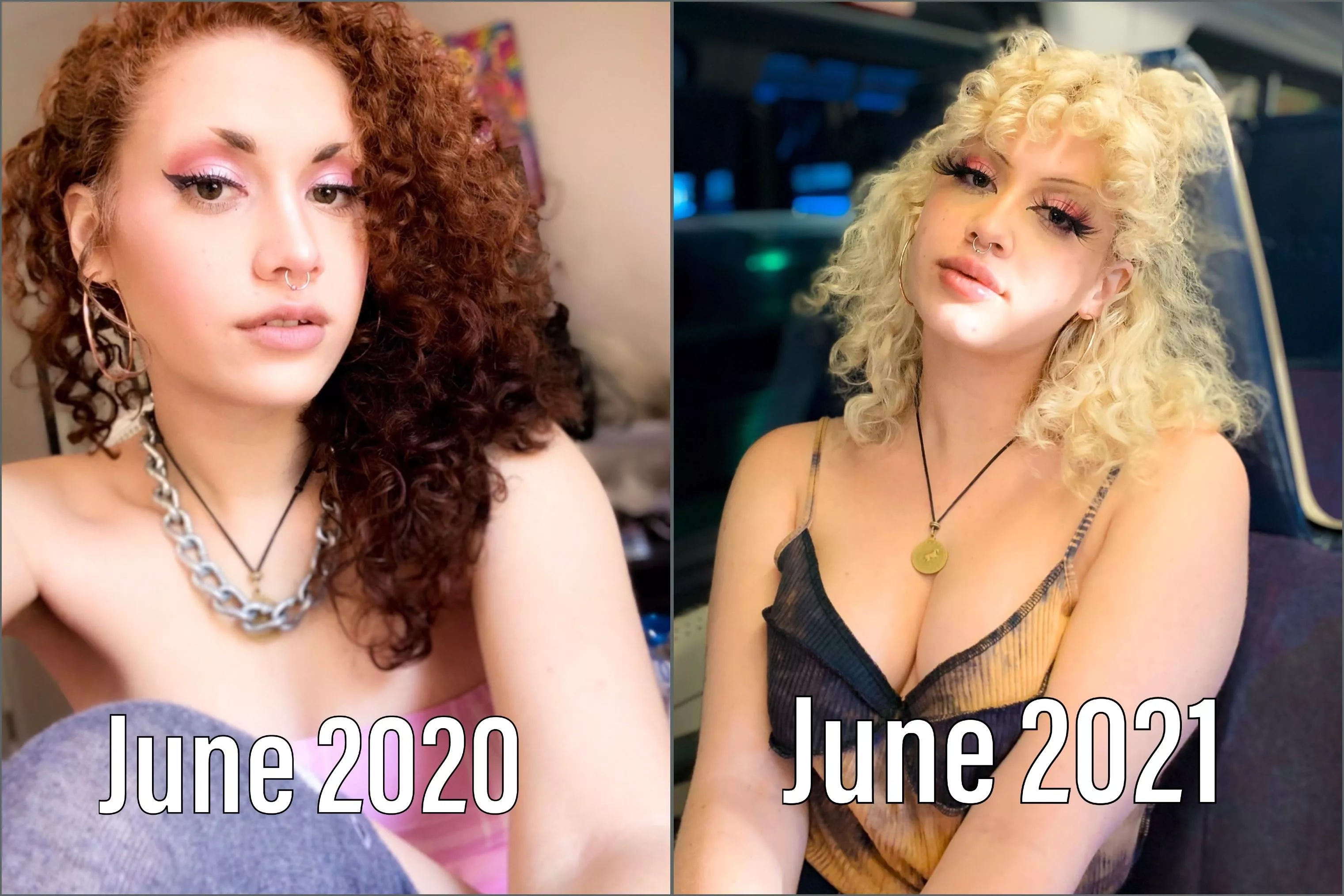 A year of difference 💕 hair, lips, and botox! Already have an appointment for another ml of filler for my lips A year of difference 💕 hair, lips, and botox! Already have an appointment for another ml of filler for my lips
