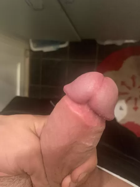 Adult circ 6 months ago, self consious about the scar, would u guys/girls be bothered by it?