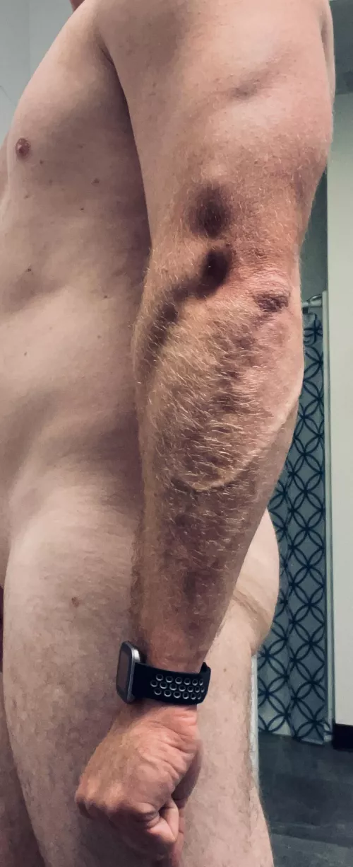 And today is a rest day😏