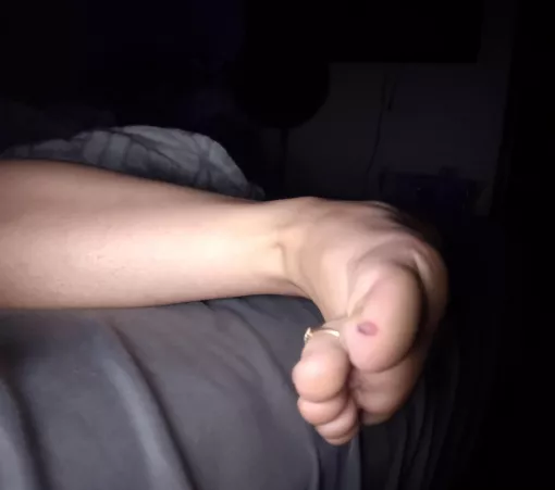 Anyone here good at kissing boo boos?😢