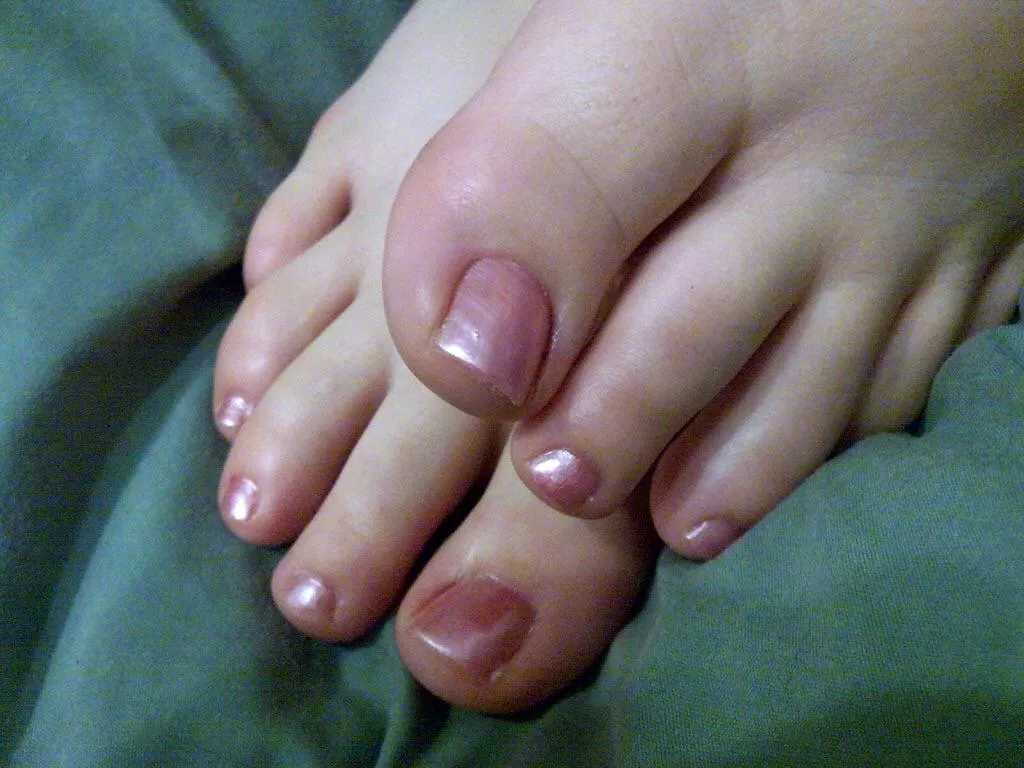 Anyone keen for a serve of my wife’s sexy little toes? 😍🤤😋