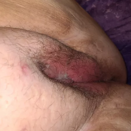 Anyone want to add another load or 5 to my creamed pussy? 35(F)