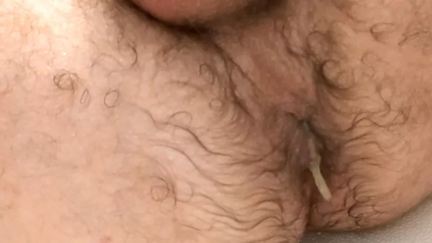 Been a few days (11-17)