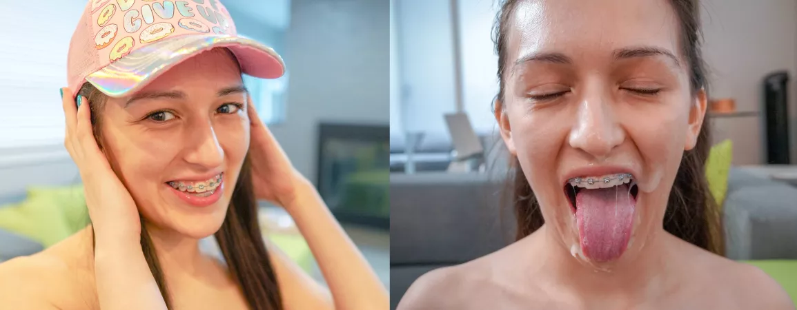 Before and a[f]ter cumshot on braces [OC] vid in comments