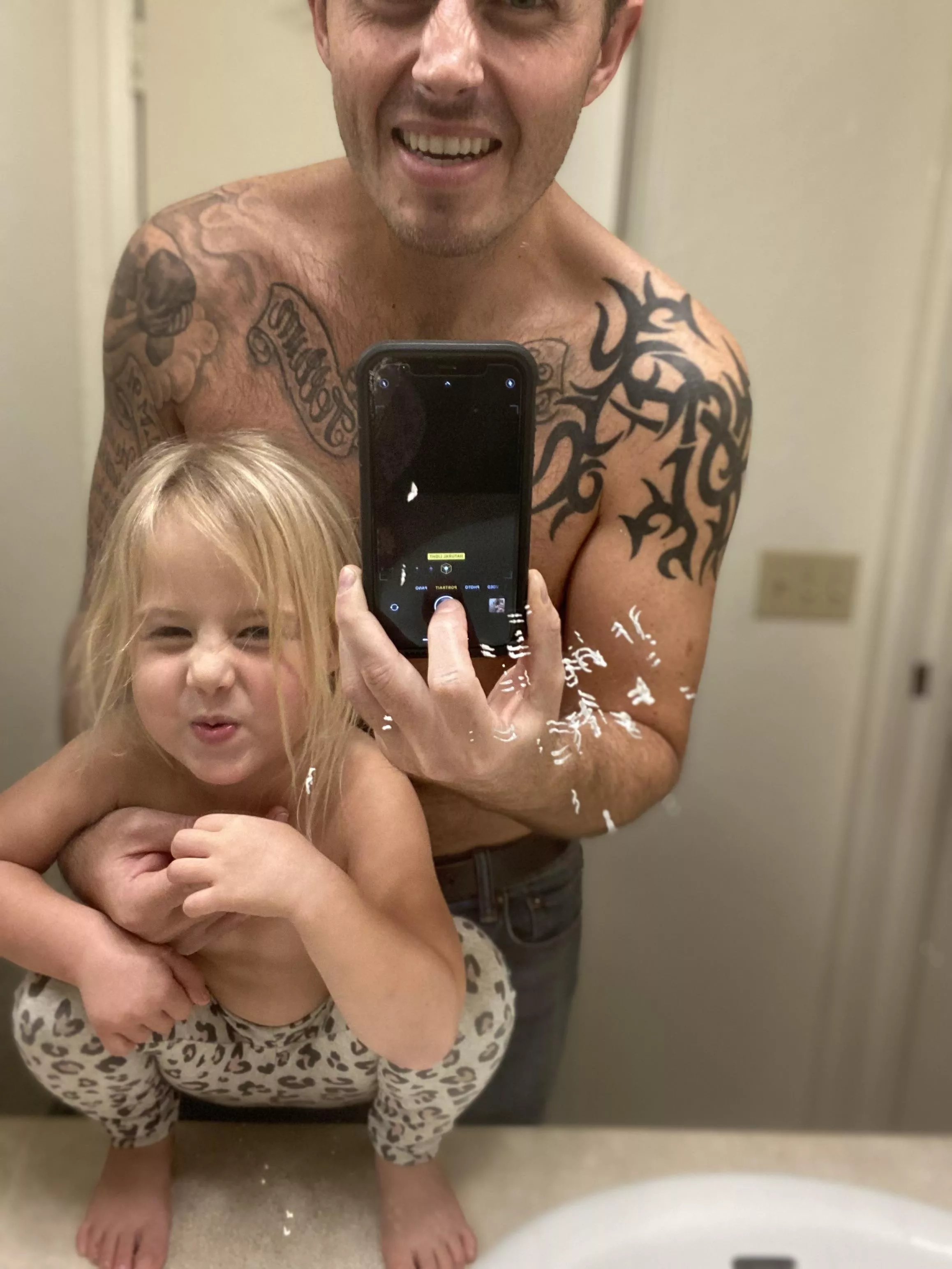 Bump that was brewing for a few months on my back. My daughter’s face says it all.