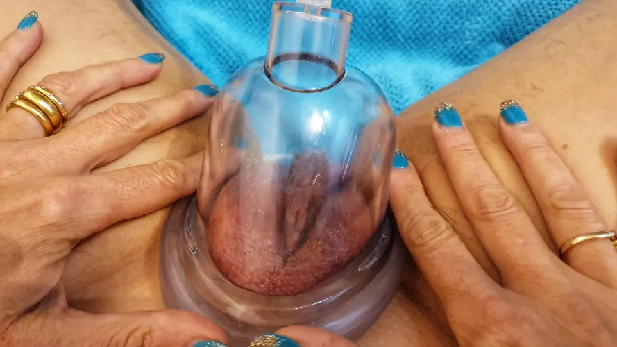 Can you see where the hood piercing used to go? [F] 🇦🇺