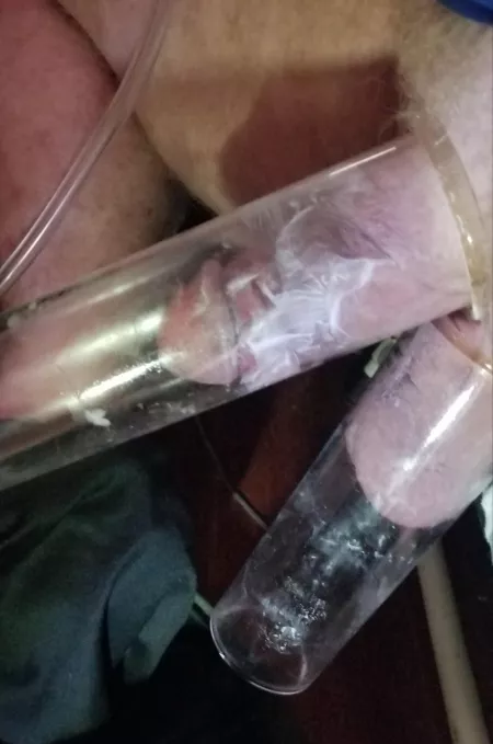 Can't speak for everyone. This was difficult to accomplish and uncomfortable when I got it to work. 😔