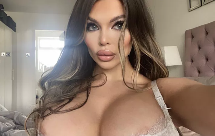 Do you like my new lips? 💋💉