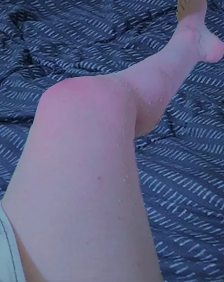 do you like pink legs and feet?