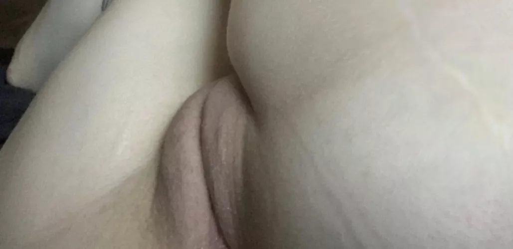 Does stepsis deserve the B===D