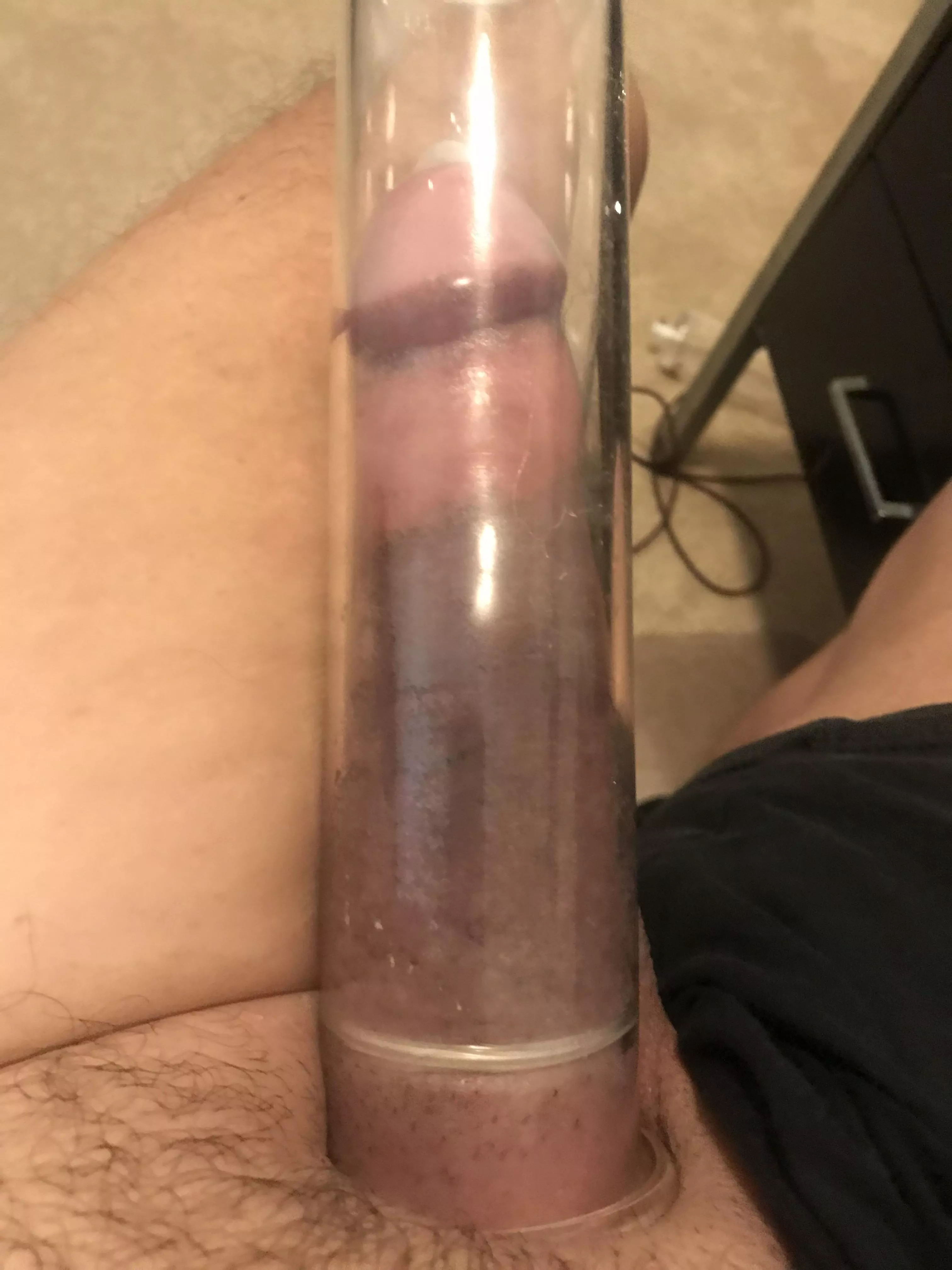 First time pumping with a condom. Shame that XL condoms are not longer and wider. This one left a deep purple line at the base of my shaft. First time pumping with a condom. Shame that XL condoms are not longer and wider. This one left a deep purple line at the base of my shaft.