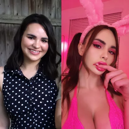 got my lips done !! should I go bigger? 💖 this is my transformation so far!!!