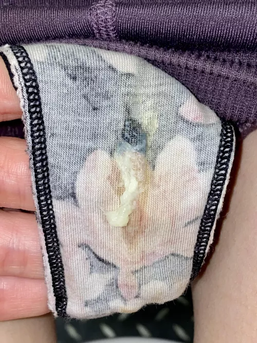 Guarantee you have not seen gooey-ness like this before🤍