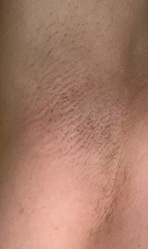 Had to shave them for a date last night 😢