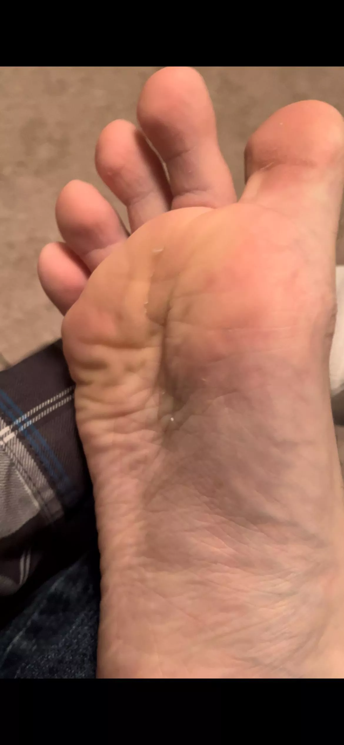 “Hey bro! 20 bucks says you can’t hold your face in my foot for a full minute! Readysetgo—“