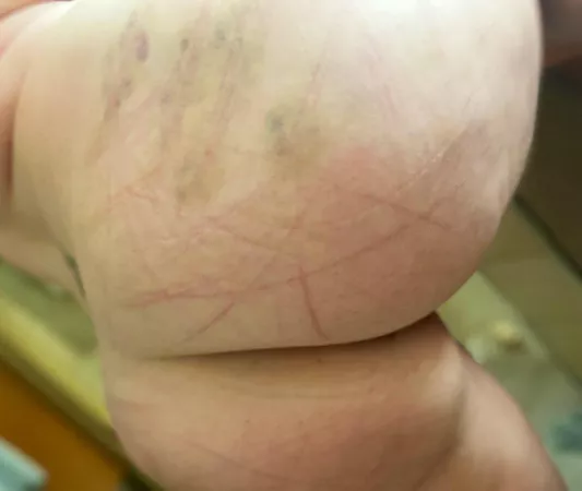 I absolutely love his marks on me