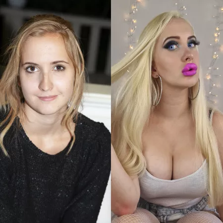 I get 2 more ml in my lips in 6 days and my expanders in spring 2022 😍