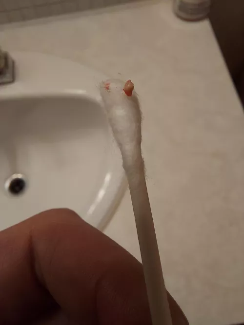 I had a sore bump in my ear all week and this popped out along with some grey slime. Felt better afterwards though