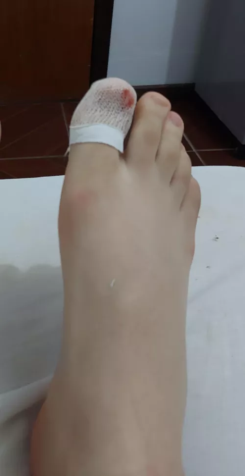I hurt my toe 🥺🥺 can someone take care of it for me [19]