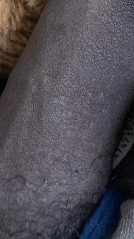 I just want to know if I’m ok why is my dick so black do that mean anything