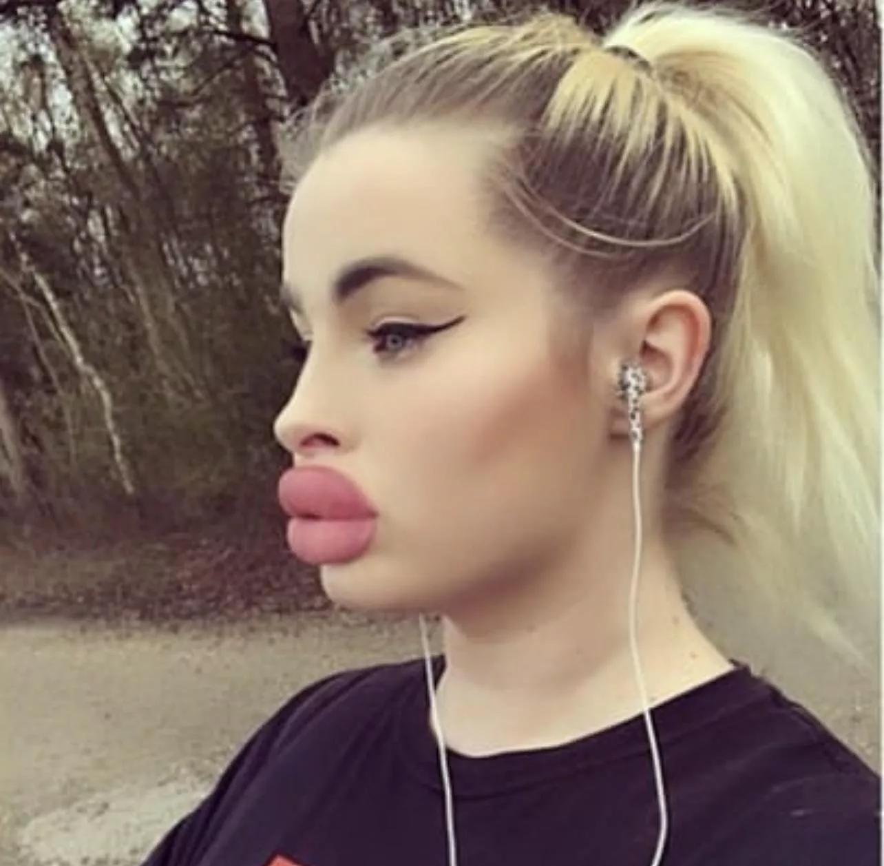 If your lips are drastically altering your side profile, you’re on the right track