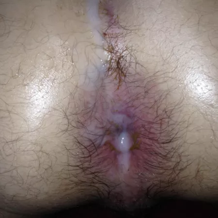 Is it bad that I spend the World AIDS Day with my legs open for all dick every year & even better if I know they are toxic