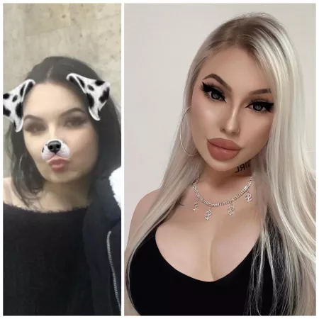 me after fillers and boobs augumentation😈🔥perfect doll🤪