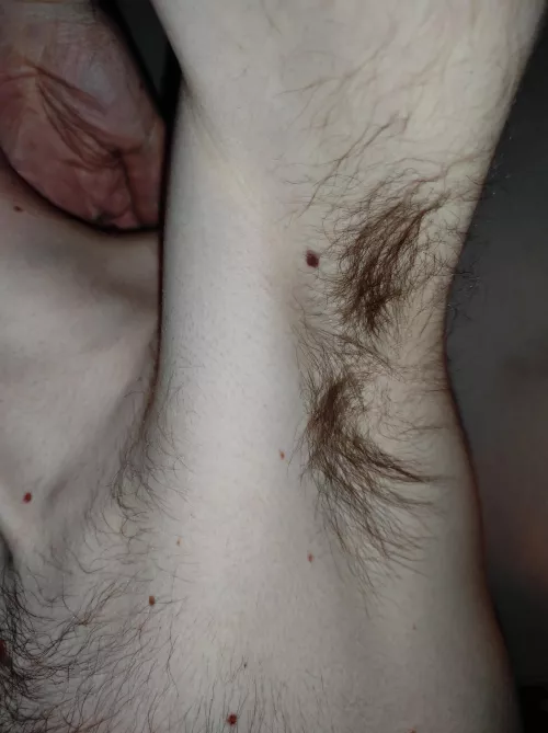 My pits are pretty hairy, aren't they?