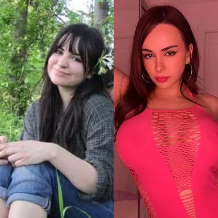 my transformation so far 💞 this monday i’m getting my lips done!! woo!!