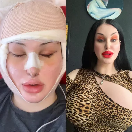 [TS Bimbo] I need to be so much more plastic. FILL ME!