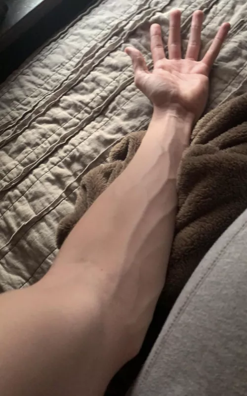 Vein check