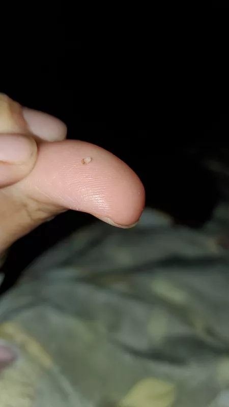 Was scratching my head and felt a bump, ended up pushing this beauty out