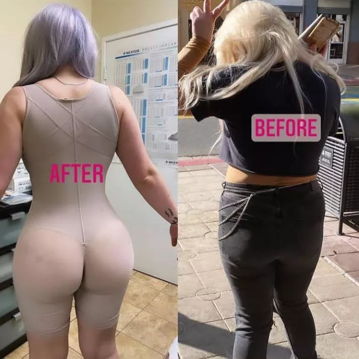 We reached 100k members on r/BoltedOnBooty! Thanks for your support and this a remainder that fake is better here We reached 100k members on r/BoltedOnBooty! Thanks for your support and this a remainder that fake is better here