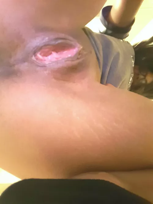 Wife's bald beef wide open