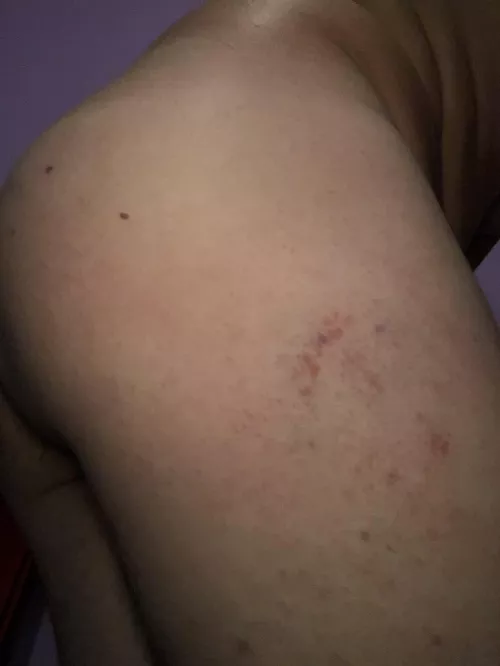 Woke up with a slightly bruised ass after a well-deserved whipping last night